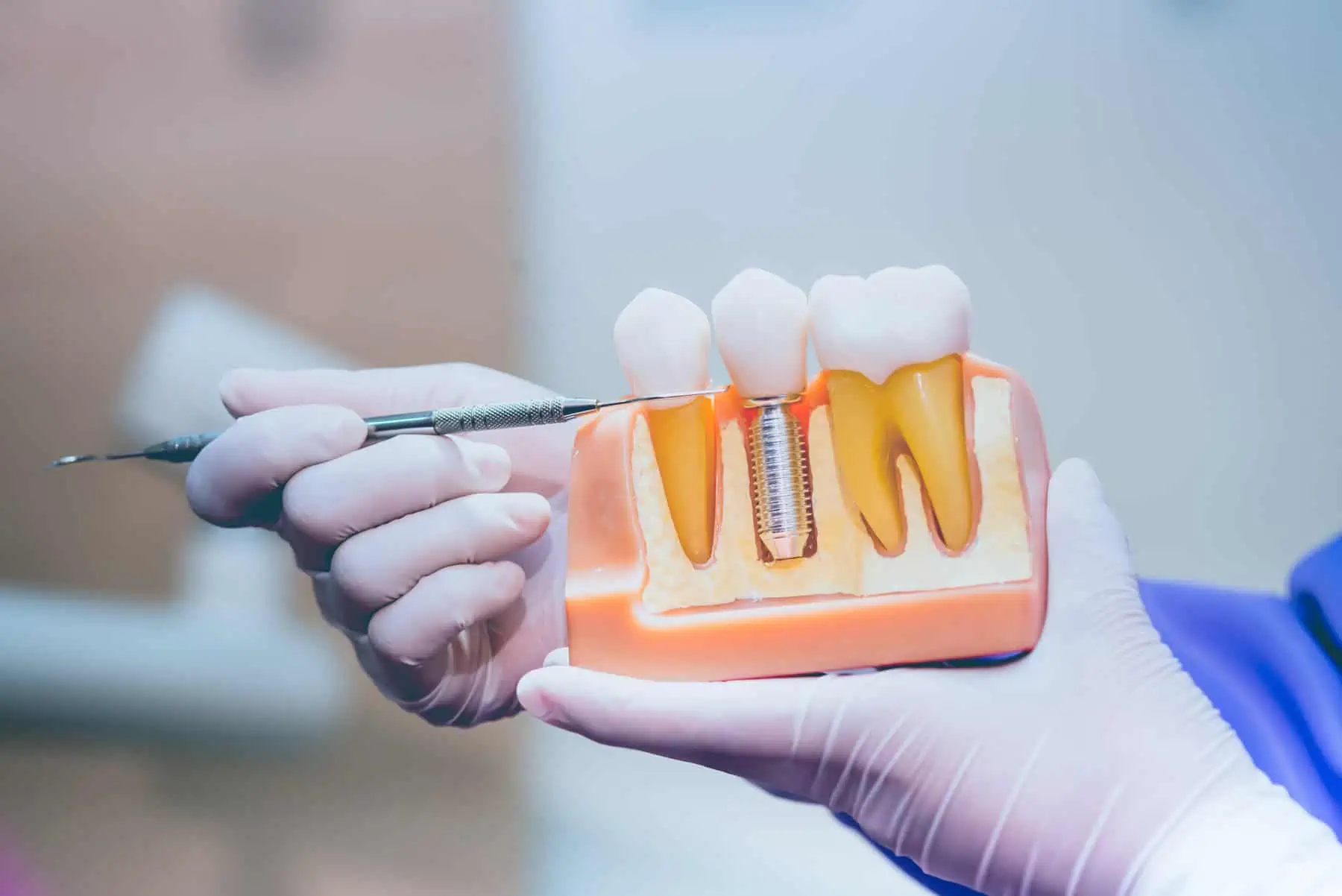 Woman with a healthy, restored smile after dental implant treatment
